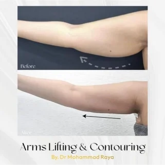 1747107224-65124207-321x321-352462898-2274951952