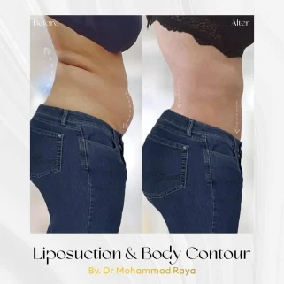 1747107225-65124218-321x321-353742307-3309736162