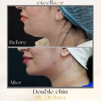 1747107228-65124255-321x321x321x326x0x3-417120742-1800125865