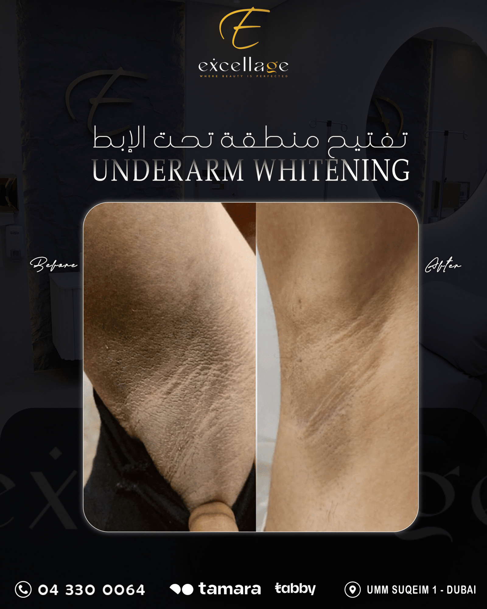 underarm whitening 2
