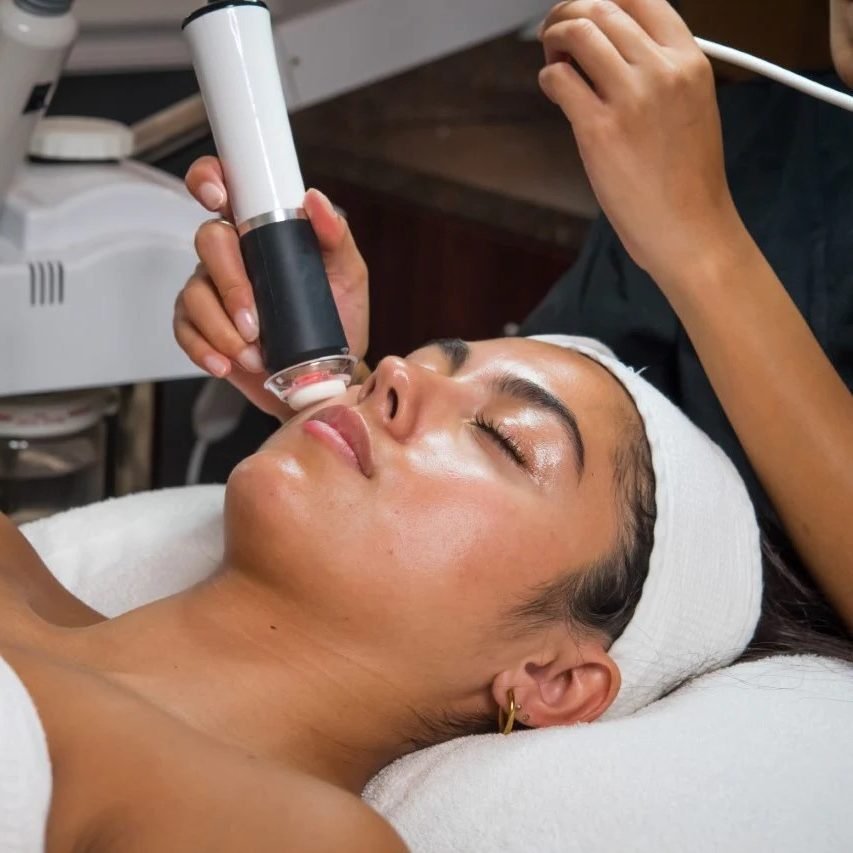 oxygeno facial facial acne