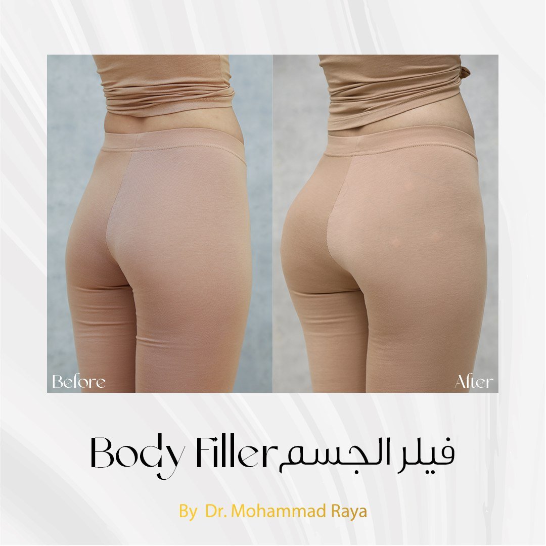 photo_2023-08-08_14-13-05