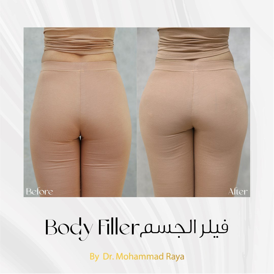 photo_2023-08-08_14-13-08